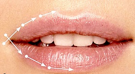 Линейная техника иглой увеличения губ 