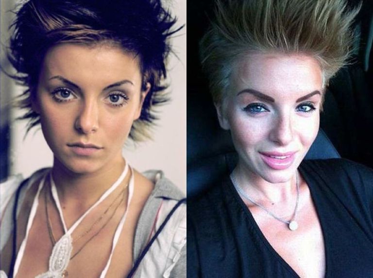 Юлия Волкова на фото до и после пластики лица