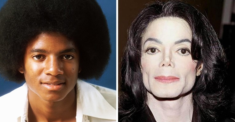 Майкл Джексон до и после операции