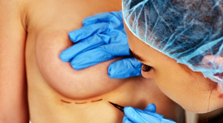 Подготовка к операции на груди 