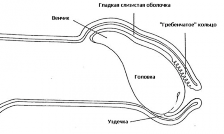 Коронарное ребро у мужчин где находится картинка